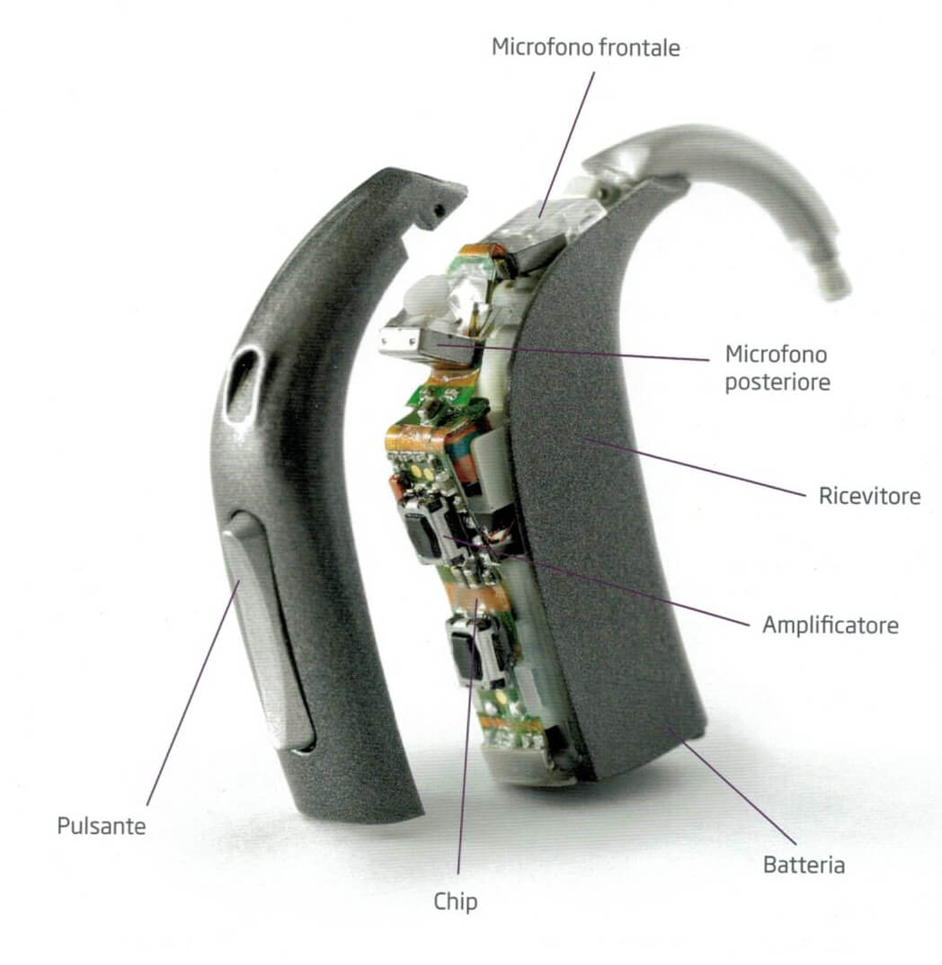 I moderni apparecchi acustici - Audiomedical